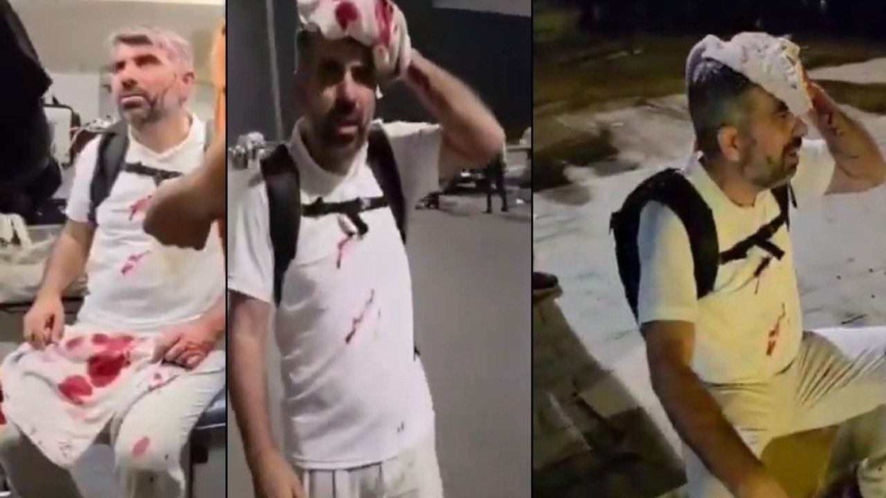 HÜDA-PAR’lı vekil başından yaralandi